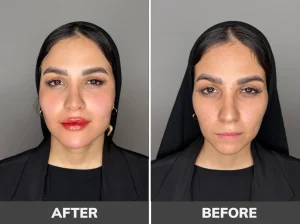 عکسهای قبل و بعد از کانتورینگ با ژل