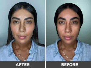 عکسهای قبل و بعد از کانتورینگ با ژل
