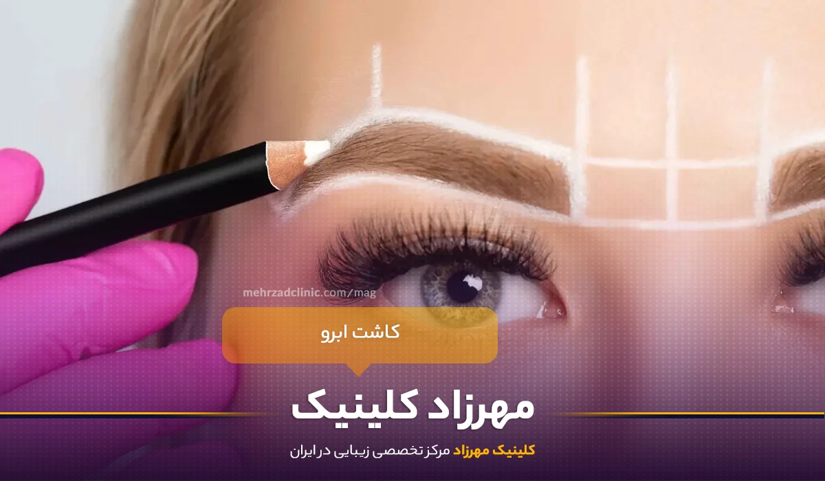 کاشت ابرو : جایگزینی طبیعی و کم هزینه نسبت به سایر روشها