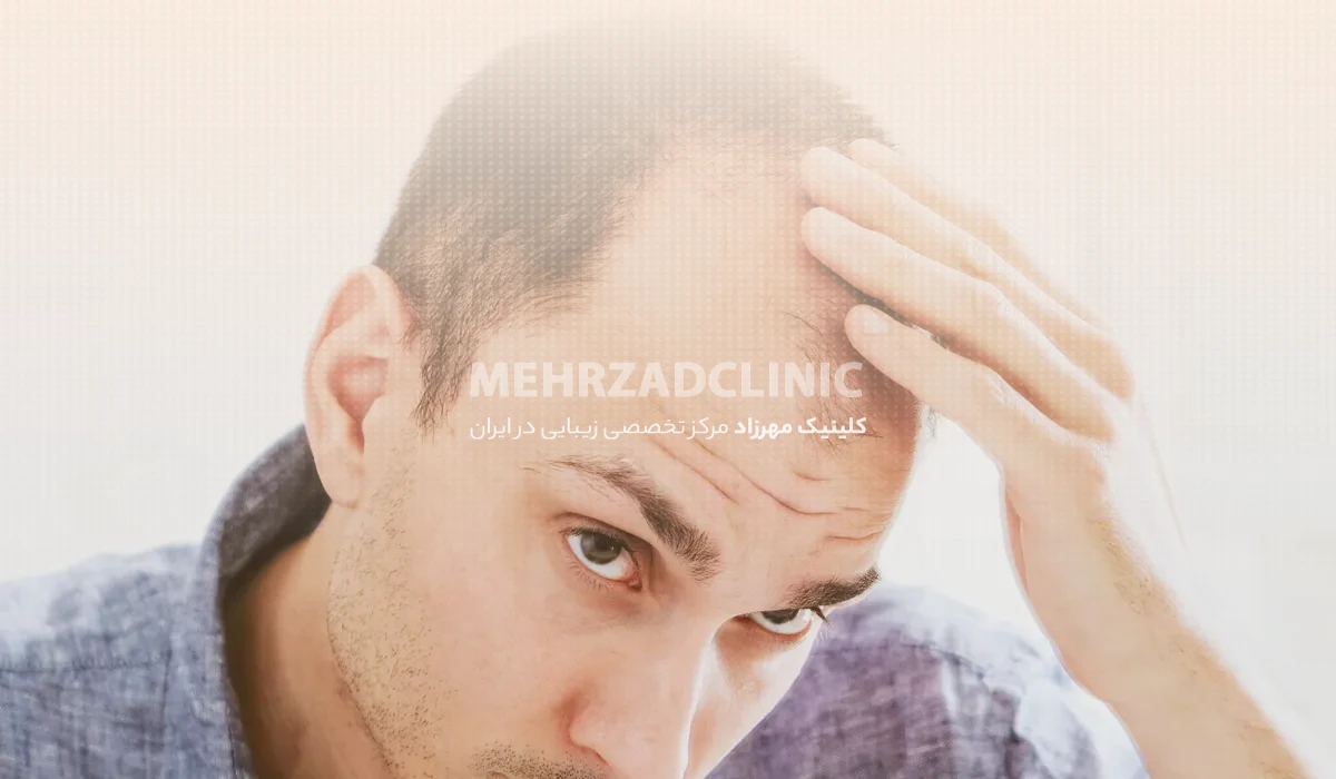 کاشت مو به روش میکروفیت : تکنیکی نوین و مزایای آن