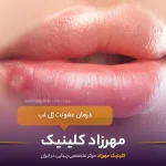 درمان عفونت ژل لب : علائم و علت آن چیست؟