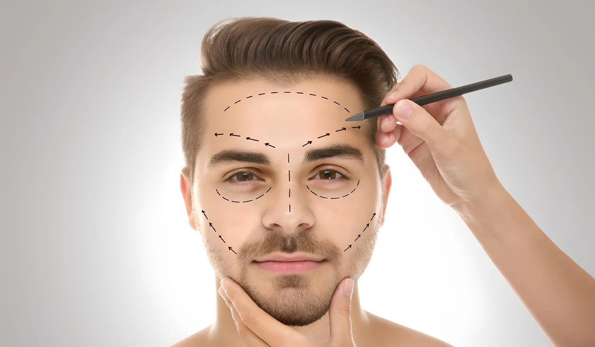 لیفت صورت مردانه : آقایان هم از این روش استفاده می‌کنند؟