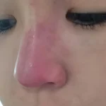 post-thumbnail