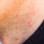 post-thumbnail