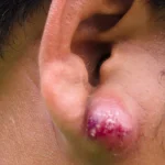 post-thumbnail