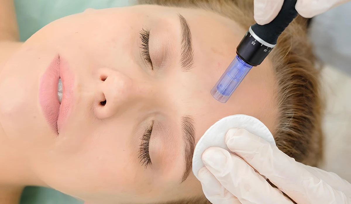 مزوتراپی صورت در خانه : آیا واقعا ممکن و موثر است؟