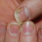 post-thumbnail