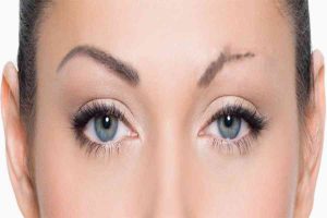 افراد مناسب کاشت ابرو