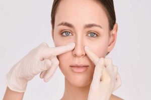 فرایند رینوپلاستی