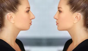 اهداف کانتورینگ با ژل شامل چه مواردی است