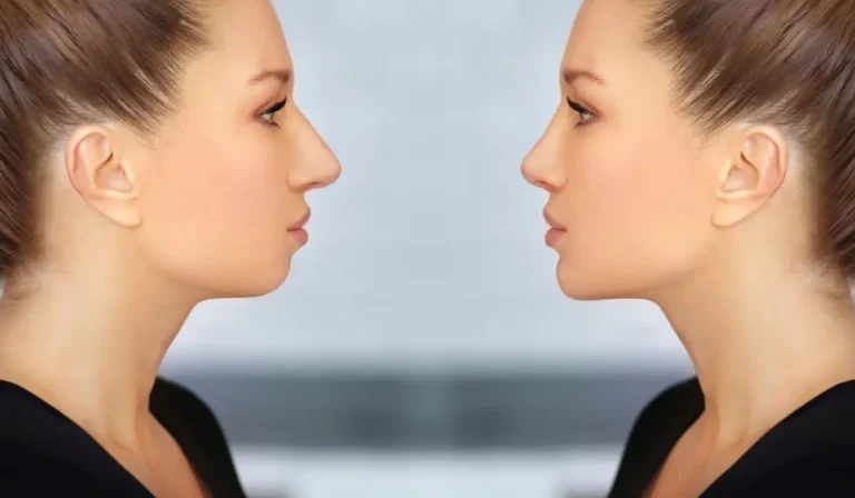 اهداف کانتورینگ با ژل شامل چه مواردی است