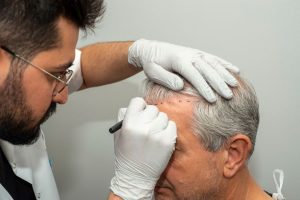 انتخاب جراح کاشت مو