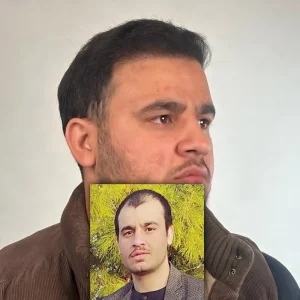 عکس کاشت مو بعد از 4 ماه