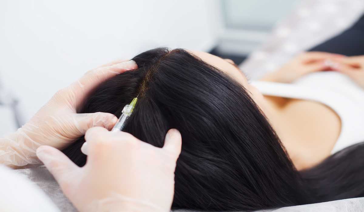 نقش بیوتکنولوژی در کاشت مو