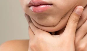 مراقبتهای پس از لیپوساکشن غبغب چه تاثیری بر نتایج پس از عمل دارد؟