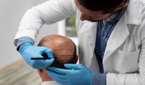 کاشت مو و درمانهای مکمل