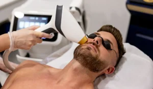لیزر موهای زائد برای مردان