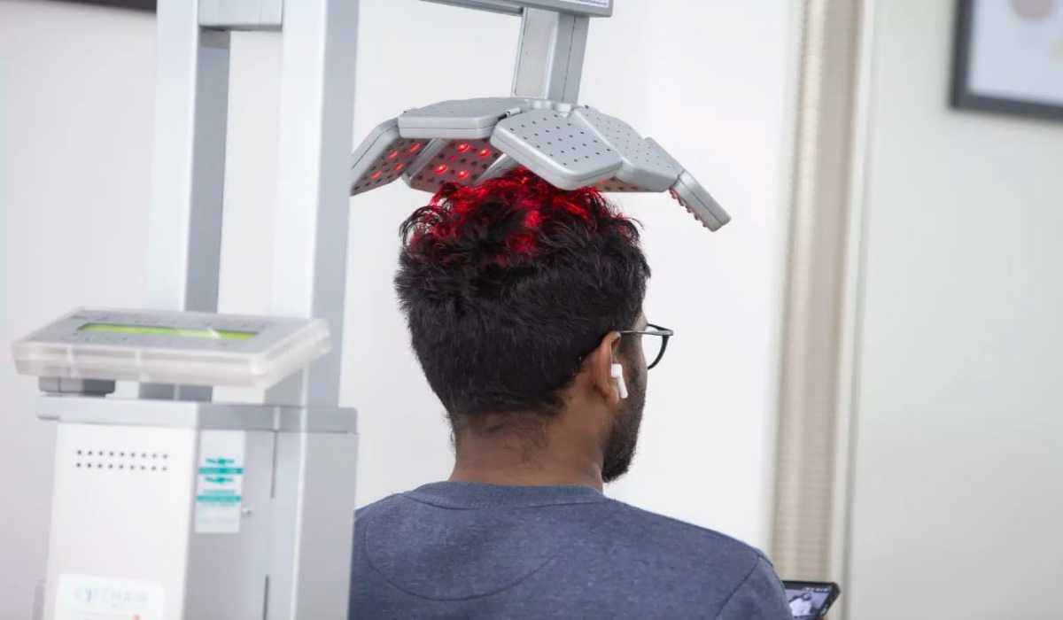 درمانهای مکمل کاشت مو