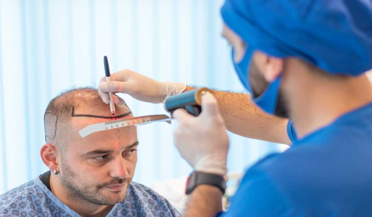 روش استخراج واحد فولیکولی (FUE) از تحول در روشهای کاشت مو