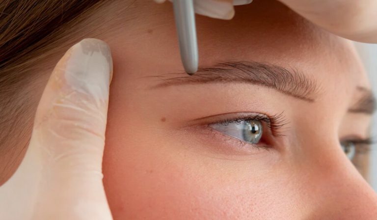 ترمیم زخم با کاشت ابرو