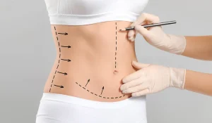 پیکر تراشی بدن چیست و چگونه انجام میشود؟