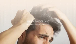 کاشت مو به روش DHI : معرفی، مراحل و مزایا