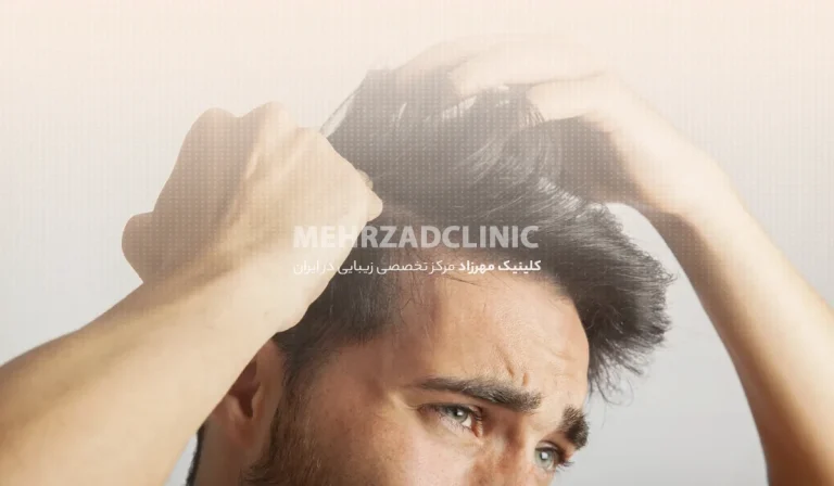 کاشت مو به روش DHI : معرفی، مراحل و مزایا