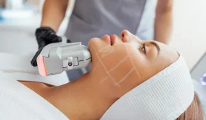 هایفوتراپی چیست : روش نوین در جوان‌سازی پوست