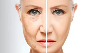 افراد مناسب تزریق چربی : چه شرایطی باید داشته باشیم؟