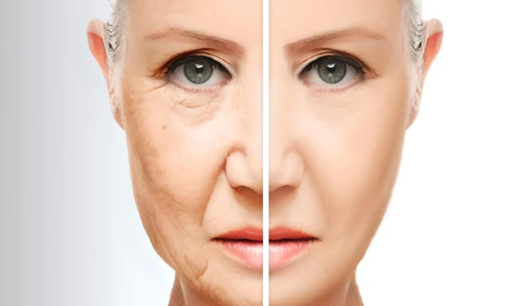 افراد مناسب تزریق چربی : چه شرایطی باید داشته باشیم؟