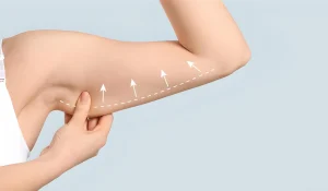 جراحی زیبایی بازو : چقدر روی تناسب اندام تاثیر دارد؟