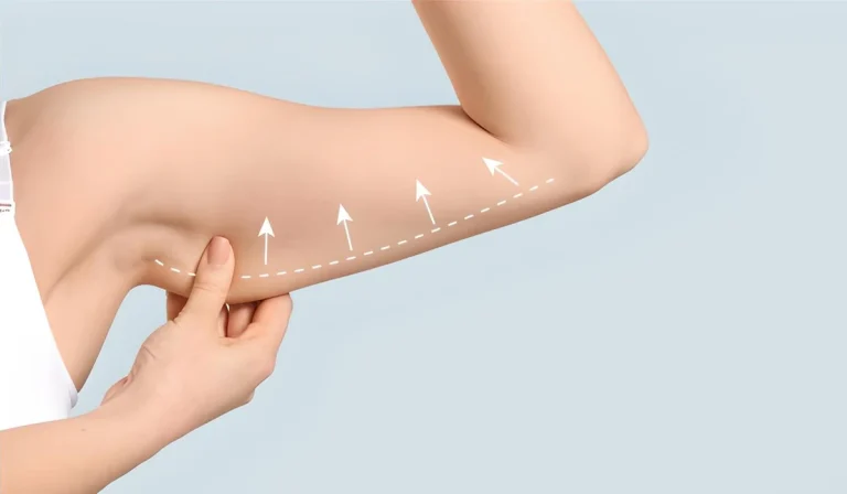 جراحی زیبایی بازو : چقدر روی تناسب اندام تاثیر دارد؟