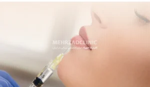 هزینه تزریق ژل : در ایران و در سال 1404 چقدر است؟