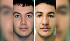 جراحی بینی گوشتی : با چه روشهایی انجام می شود و به چه نکاتی باید توجه کرد؟