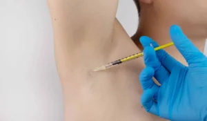 بوتاکس زیر بغل : راهکار مؤثر برای درمان تعریق بیش از حد