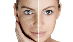 ۱۱ روش‌ جوانسازی پوست : معرفی انواع تکنیکها