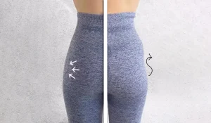 فیلر بادی : جوانسازی و افزایش حجم نواحی مختلف بدن