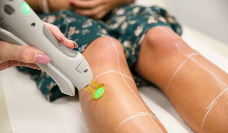 لیزر شاتی و رولی : کدام دستگاه بهتری است؟