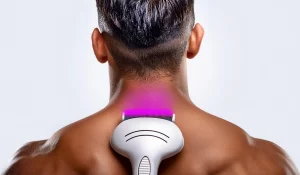 لیزر فول بادی : حذف دائمی موهای زائد از تمامی نواحی بدن