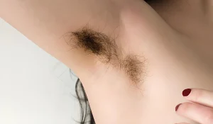 عوامل رشد موهای زائد : چه عامل‌هایی باعث افزایش موهای ناخواسته می‌شود؟