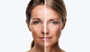 روشهای درمان افتادگی صورت : تهاجمی و غیر تهاجمی