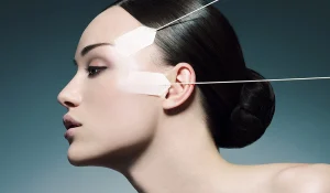 هزینه لیفت صورت با نخ : در ایران و در سال 1404 چقدر است؟