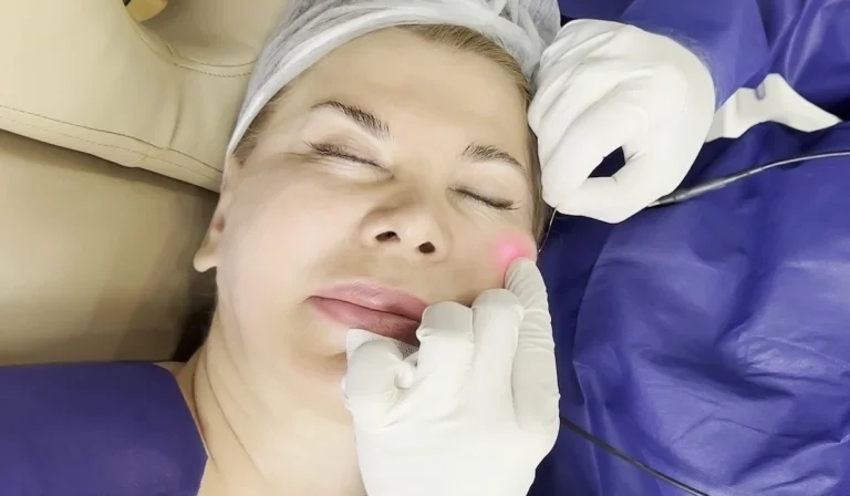 اندولیفت : روشی غیر تهاجمی و پیشرفته برای زیبایی و رفع چین و چروک