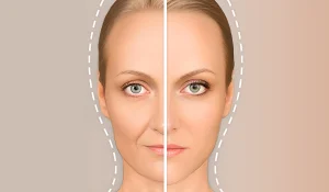 مدت ماندگاری تزریق چربی در صورت و بدن چقدر است؟