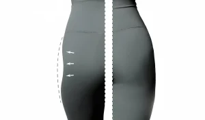 هیپ دیپ یا گودی بغل ران: برای درمان آن چه روشی مناسب است؟