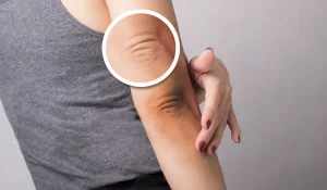 رفع تیرگی زانو و آرنج : از روشی بهتر است استفاده کنیم؟