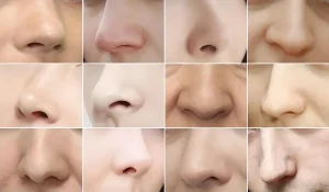 ۱۵ فرم محبوب بینی : از بینی یونانی و رومی تا بینی باربی!