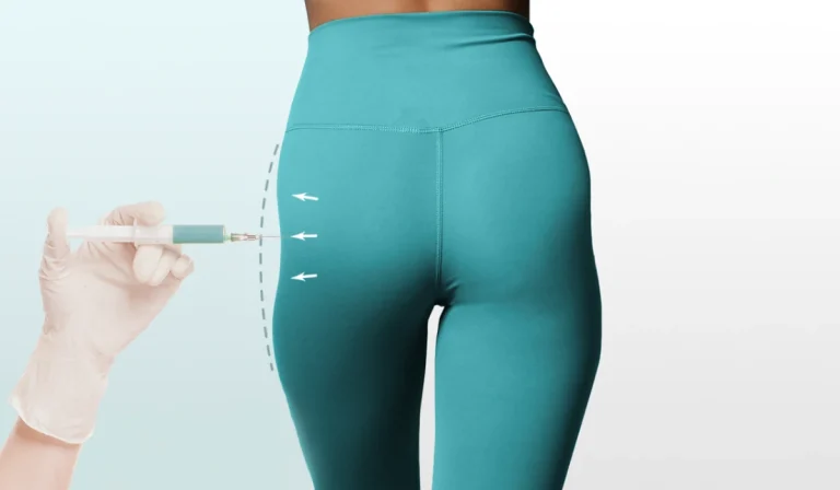 فیلر هیپ دیپ : راهی برای رفع فرورفتگی‌ بغل ران و باسن