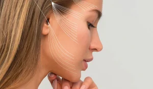 ماندگاری نخ لیفت صورت : همه چیز درباره نتایج و دوام این روش جوانسازی