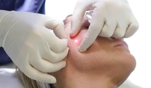 مزایا و عوارض اندولیفت : آیا اندولیفت ارزش انجام دارد؟